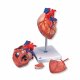 Model srdce s bypassem - 4 části