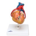 Model srdce s bypassem - 2 části - DOPRODEJ