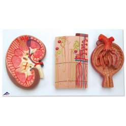 Řez ledvinou - nefrony, cévy a ledvinové tělísko