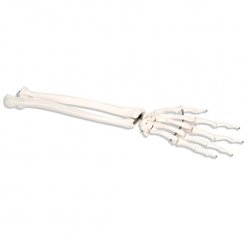 Kostra ruky s částmi kosti loketní a vřetení